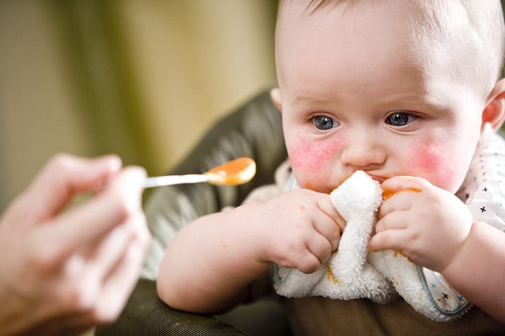 7 Unexpected Symptoms Of Carrot Allergy In Babies
