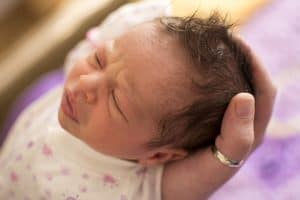 Phenylketonuria-PKU-In-Babies
