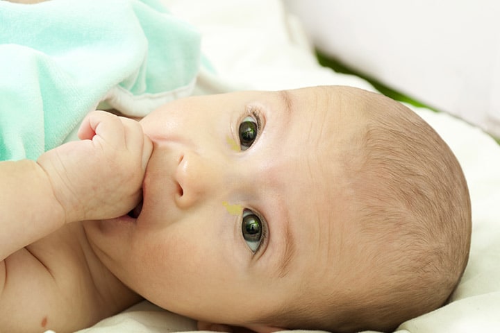 7 Effective Tips To Treat Sticky Eyes In Infants